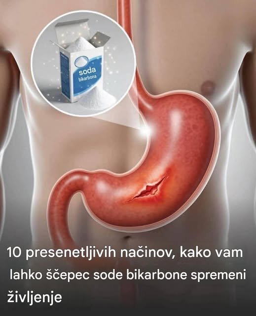 🧂 10 presenetljivih načinov uporabe sode bikarbone, ki jih je dobro poznati 786811230_1012139681857434_6163864081711957581_n